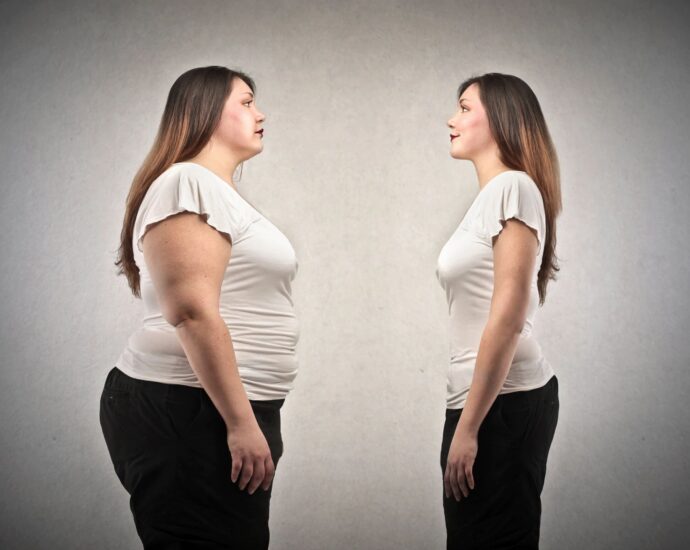 woman looking at herself before and after significant weight loss
